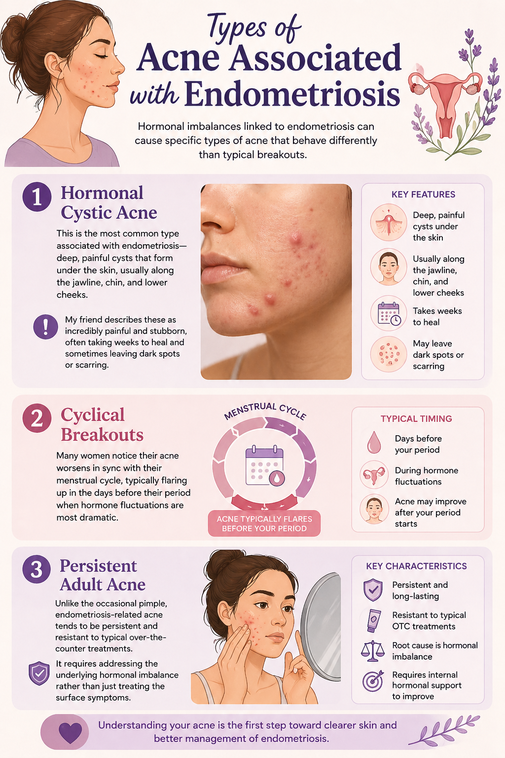 Types of hormonal acne
