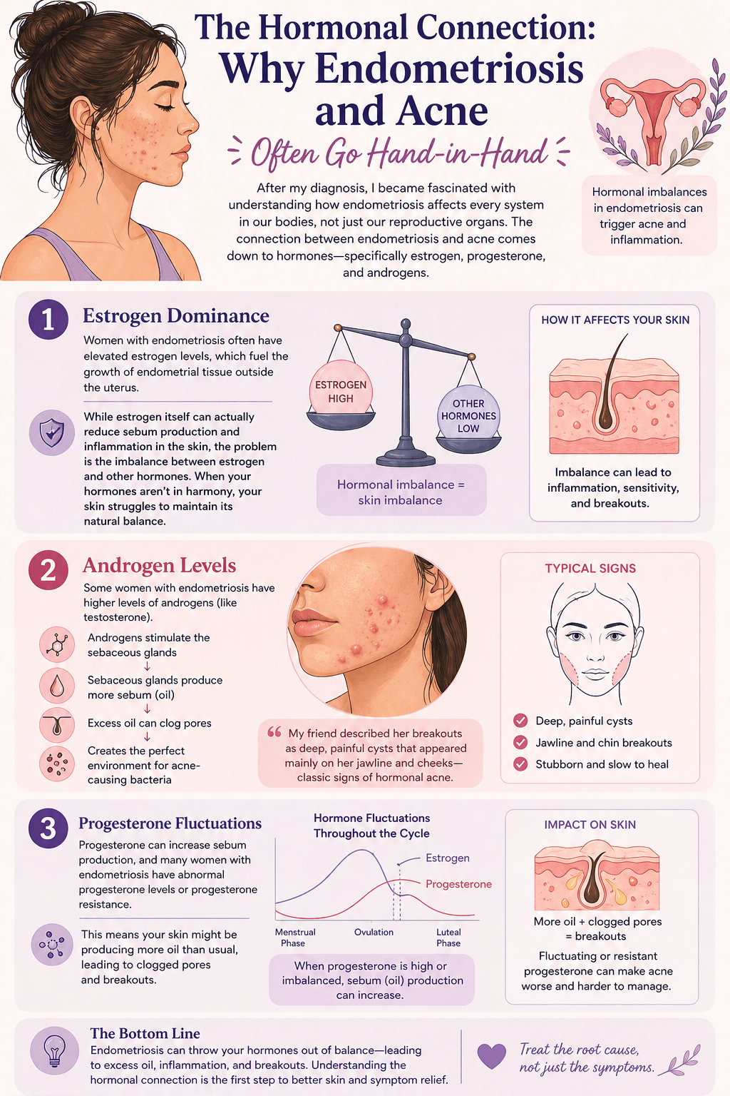 endometriosis acne hormonal connection