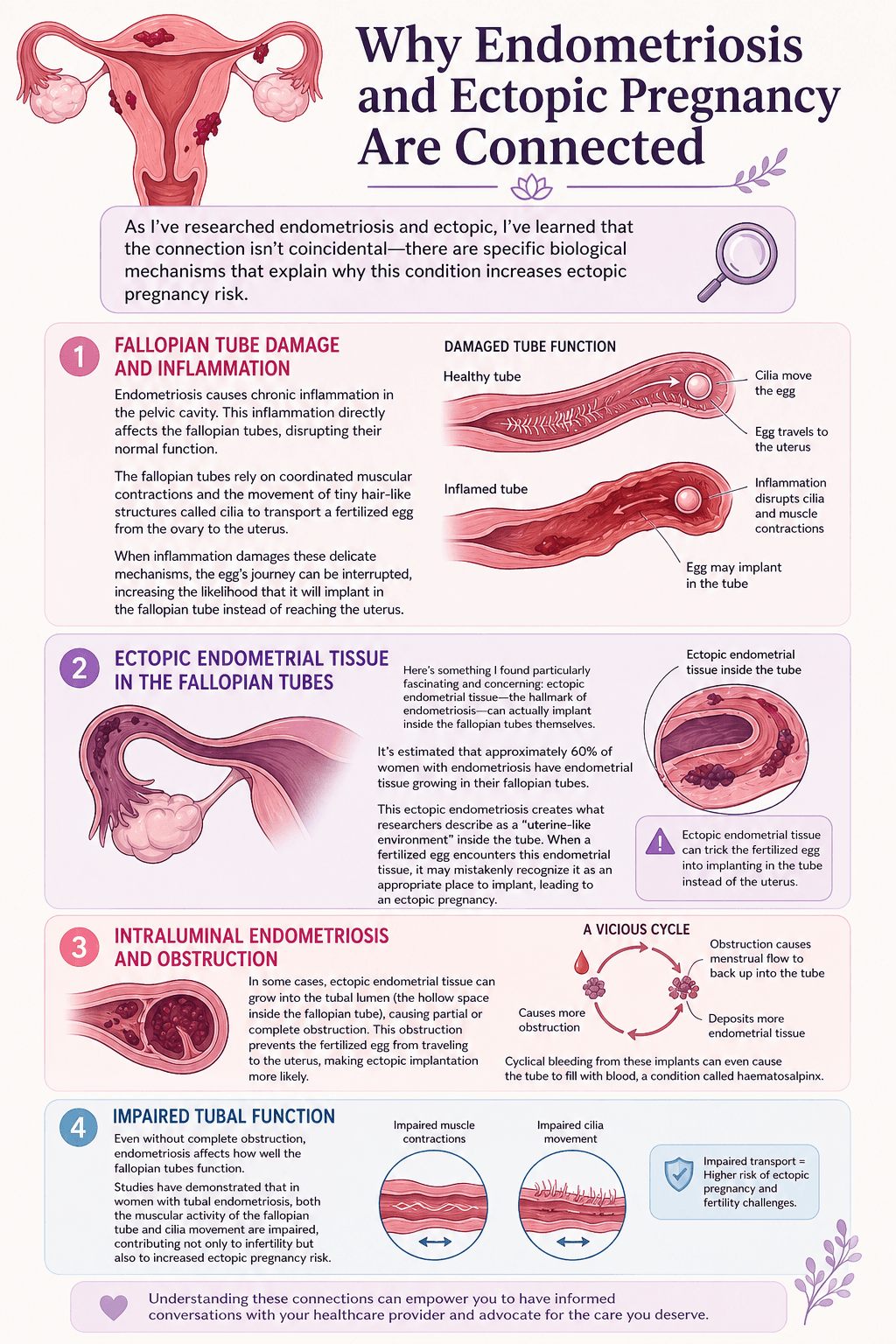 Endometriosis and Ectopic Pregnancy  Connection
